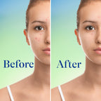 Differin 10% Benzoyl Peroxide Maximum Strength Foaming Cleanser