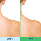Differin Acne Clearing Body Wash