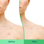 Differin Acne Clearing Body Scrub