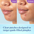 Differin Power Patch Skin Restore Hydrocolloid Pimple Patches