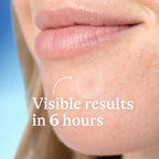 Differin Fast Fix Acne Patches