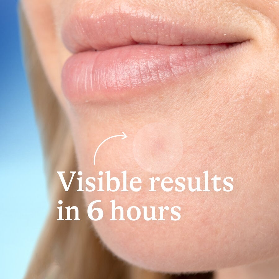 Differin Fast Fix Acne Patches