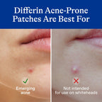 Differin Fast Fix Acne Patches