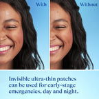 Differin Fast Fix Acne Patches